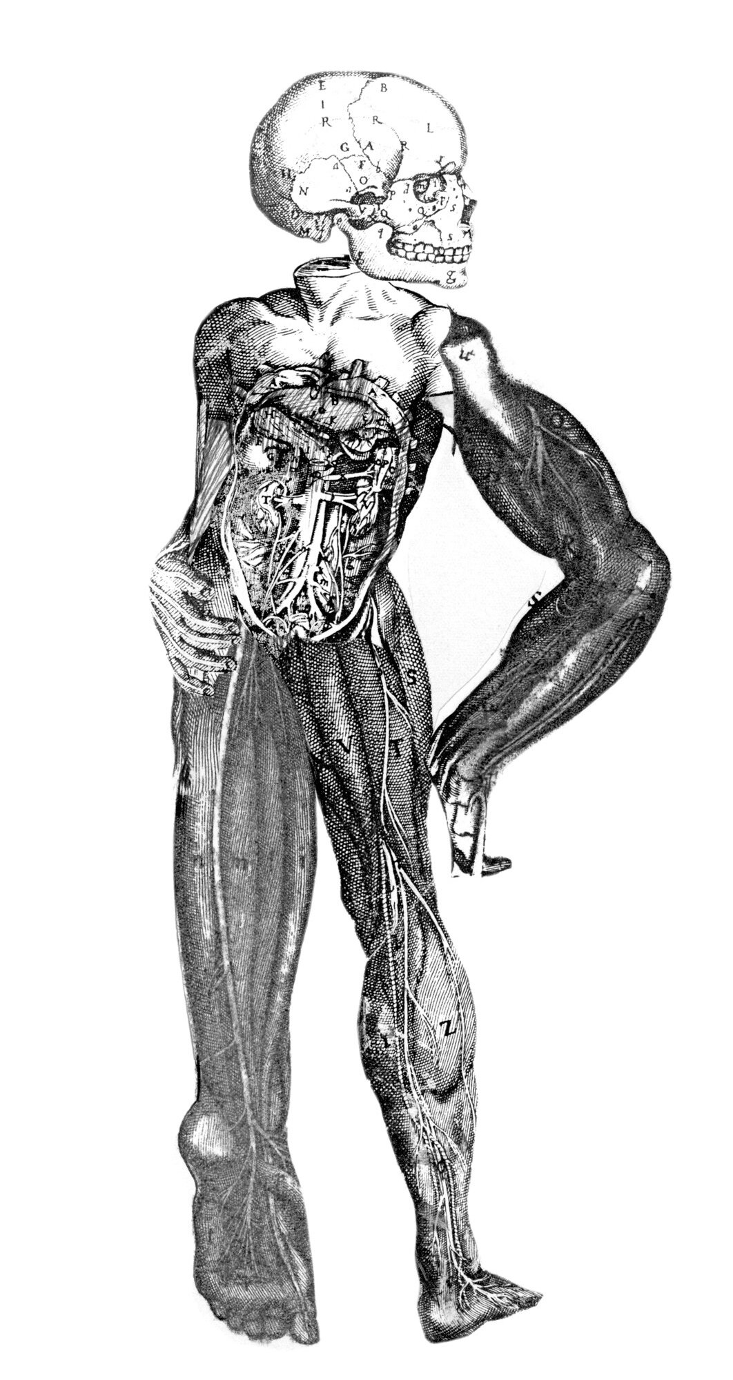 Disembodiment (Massacre)